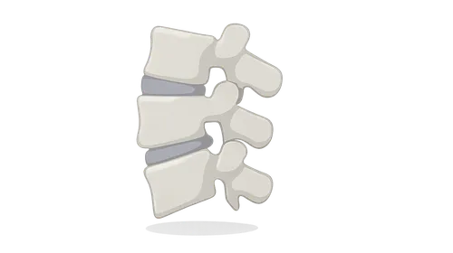 Spondylolisthesis
