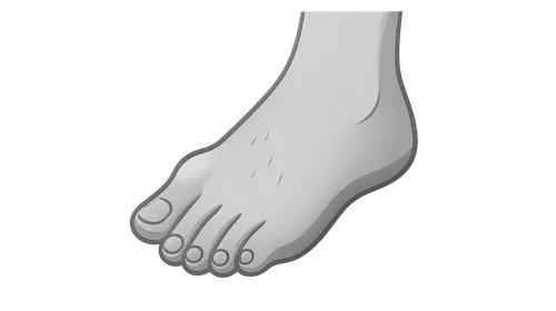 Hallux Valgus