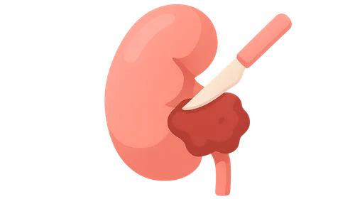 Renal cell carcinoma surgery