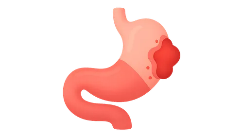 Non-traumatic Abdominal Emergencies