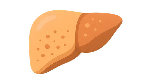 Non-alcoholic fatty liver disease