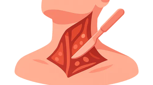 Neck Dissection Techniques