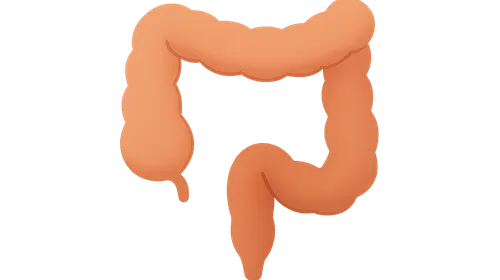 Intestinal Obstruction