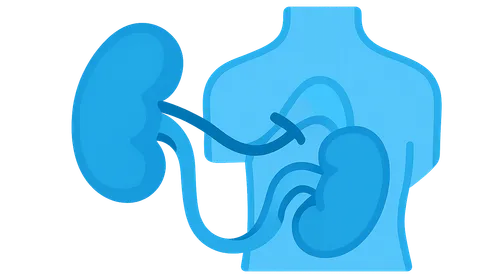 Kidney Transplantation