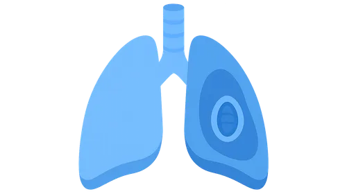 Obstructive Airway Diseases (Asthma, COPD)