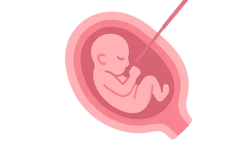 Intrauterine Fetal Therapy