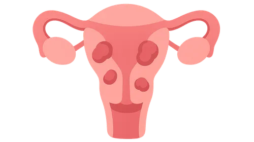 Gynecological Disorders