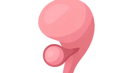 Preterm labor management