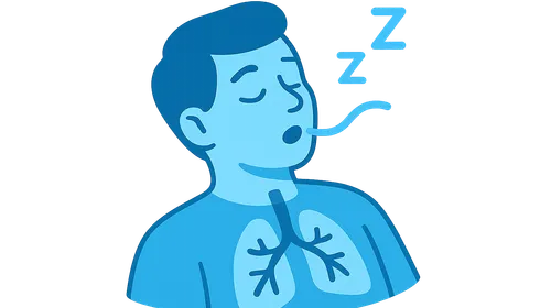 Sleep-disordered breathing