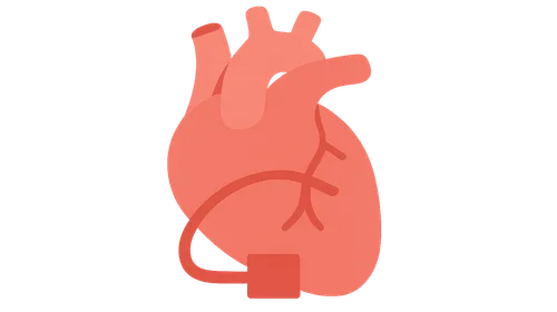 Off-Pump Cardiac Surgery