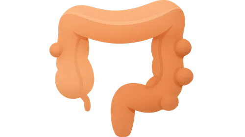 Diverticular disease