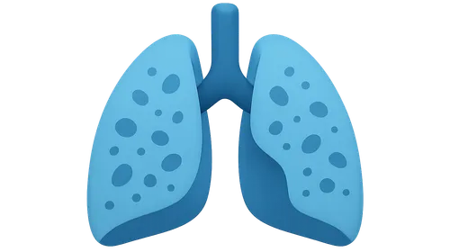 Interstitial Lung Diseases