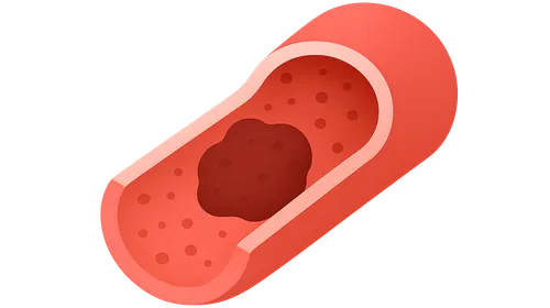 Hemodynamic disorders