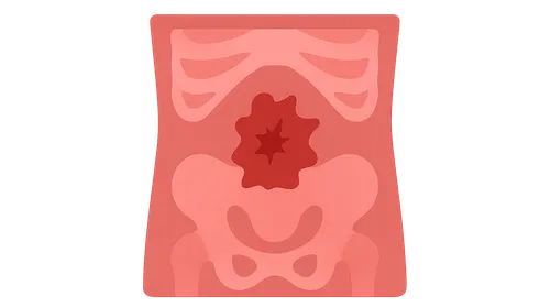 Abdominal Trauma Imaging