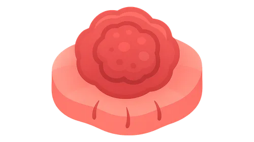 Granulomatous Inflammation