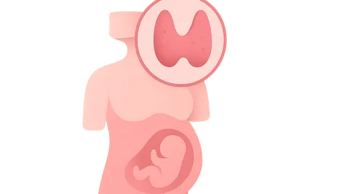 Thyroid disorders in pregnancy