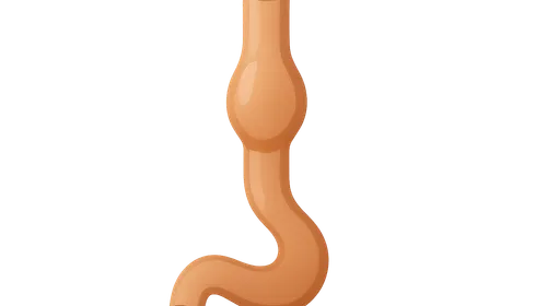 Esophageal Disorders