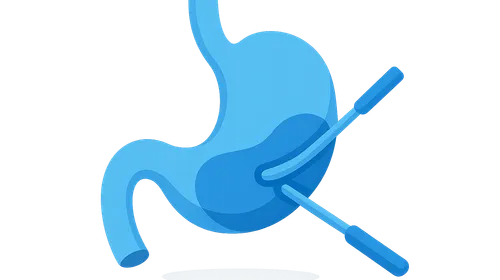 NOTES (Natural Orifice Transluminal Endoscopic Surgery)