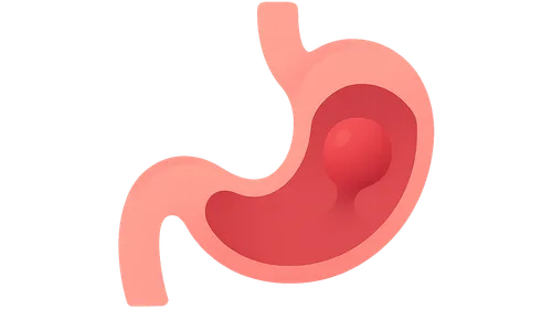 Polyps and Neoplasms