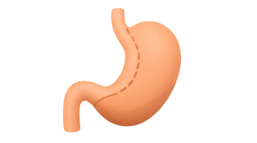 Metabolic Effects of Bariatric Surgery