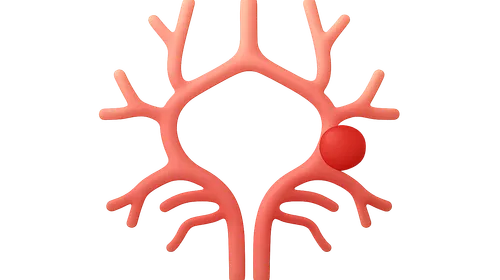 Stroke syndromes by vascular territory