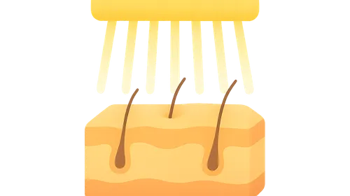 Narrow-Band UVB Therapy