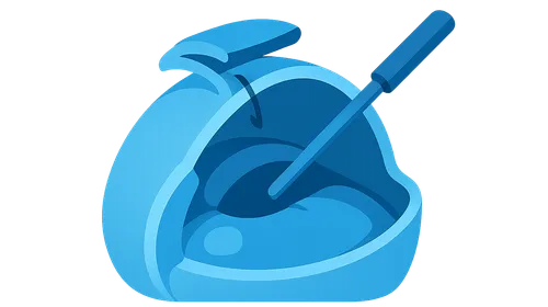 Glaucoma Filtration Surgery