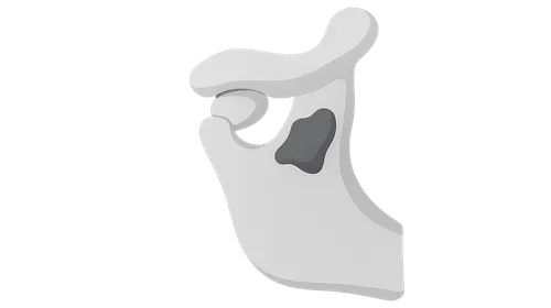 Temporomandibular Joint Disorders