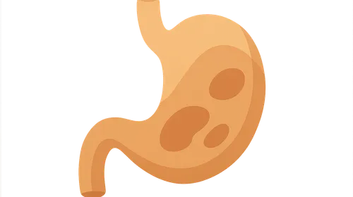 Functional GI disorders