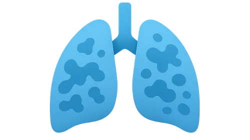 Acute Respiratory Distress Syndrome