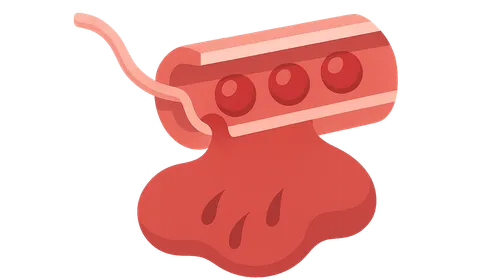 Extravasation of Contrast Media