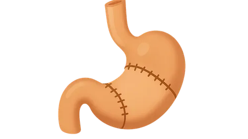 Esophageal surgery procedures