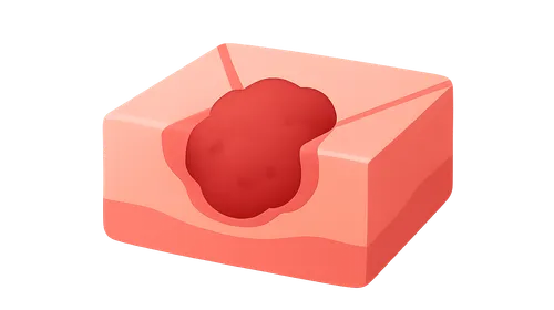 Surgical Margins in Cancer Surgery