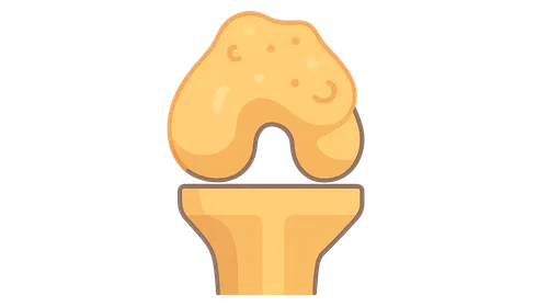 Biofilms in Orthopaedic Infections