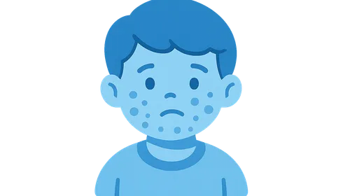 Immunology and Allergies