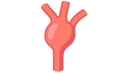 Aneurysms and dissections