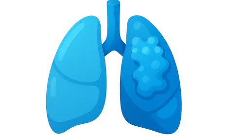 Cystic fibrosis in adults