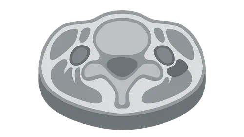 Cross-sectional Anatomy: Neck