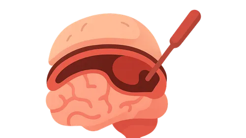 Subdural and epidural hematoma management