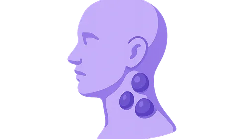 Cervical Lymphadenopathy