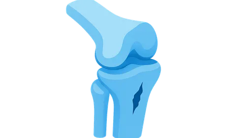 Sports medicine injuries