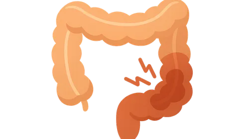 Irritable bowel syndrome