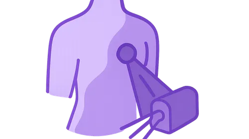 Palliative Radiation Therapy