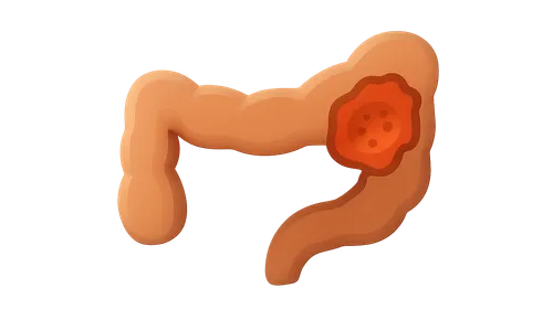 Small Intestine Pathology