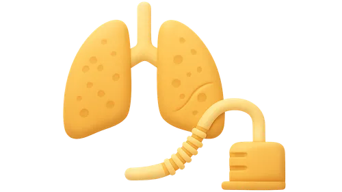 Ventilator-associated pneumonia