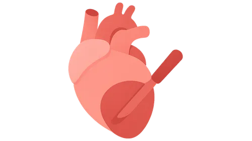 Cardiac tamponade recognition and treatment