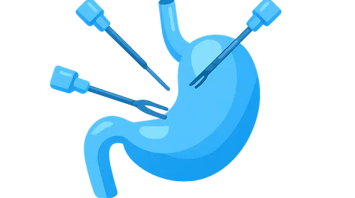 Laparoscopic Upper GI Surgery