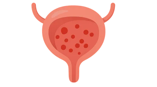 Hematuria Evaluation