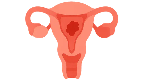 Medical management of PPH