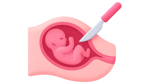 Cesarean Section: Indications and Techniques